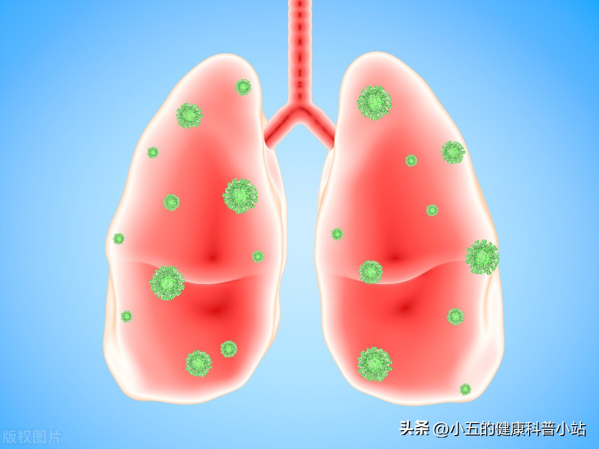 盐酸氨溴索片对支原体肺炎有效吗,盐酸氨溴索配什么消炎药治肺炎好