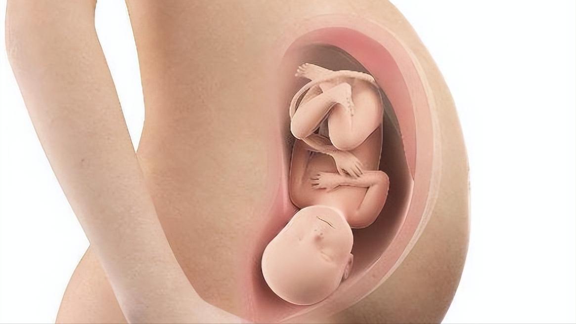 一个女人没有子宫会怎样？和正常女性有什么不同？能有夫妻生活吗