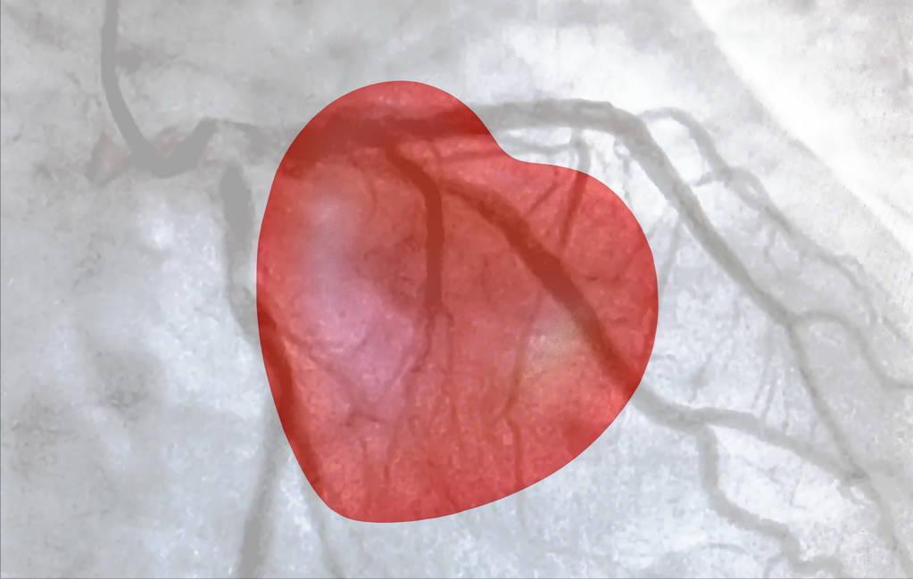 2药补气活血、化瘀开窍，降脂溶栓疏通冠脉，养心护脑兼改善抑郁
