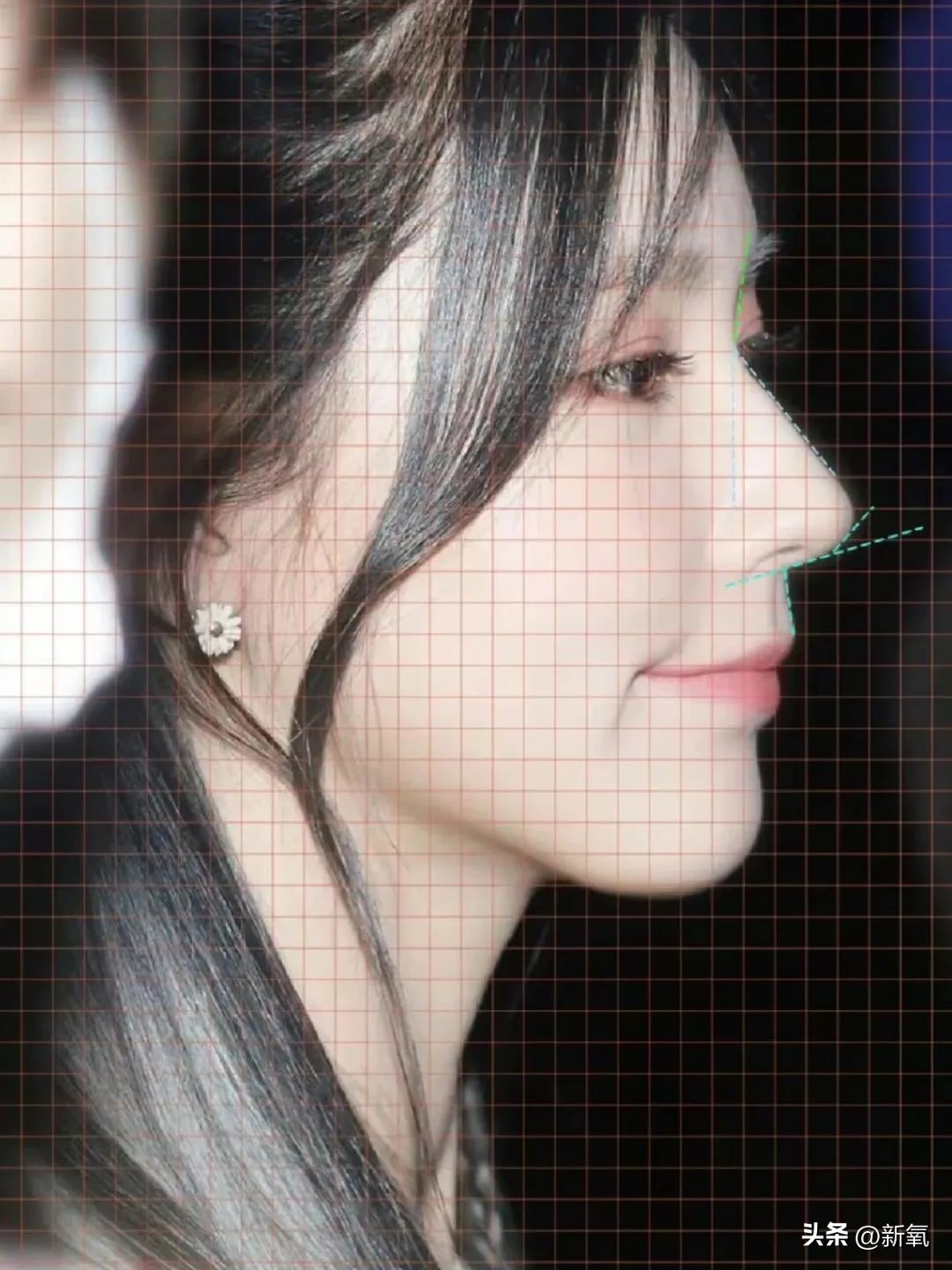 改一点赢很大？她整完鼻子直接美成断代神颜…