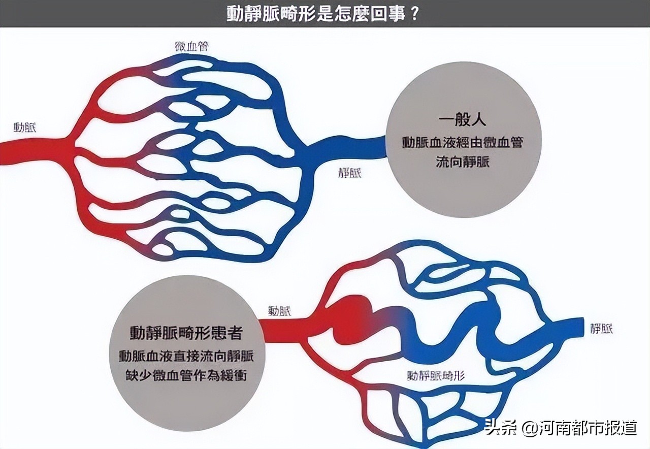 会跳动的手指,大拇指弯曲会自动抖动是什么病