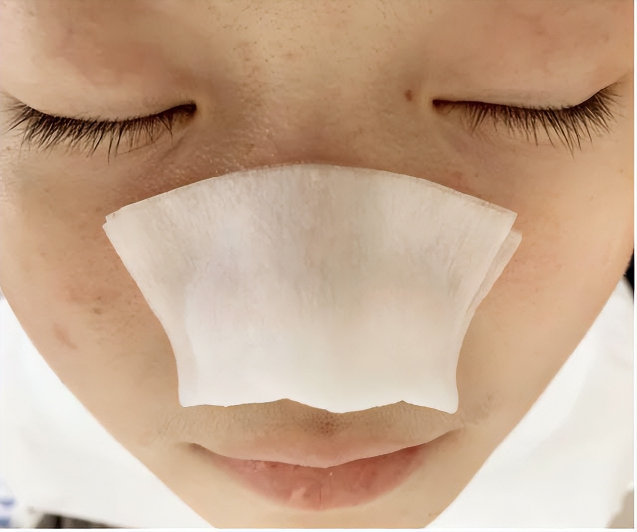 真黑头怎么去,黑头用黑头膏为什么去不掉黑头