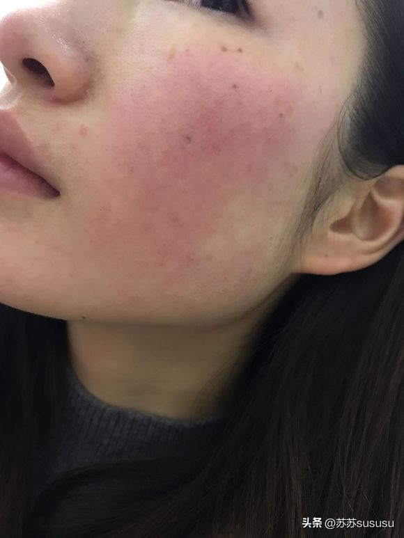 每天敷面膜皮肤真的会变好吗,敷面膜对脸真的有用吗