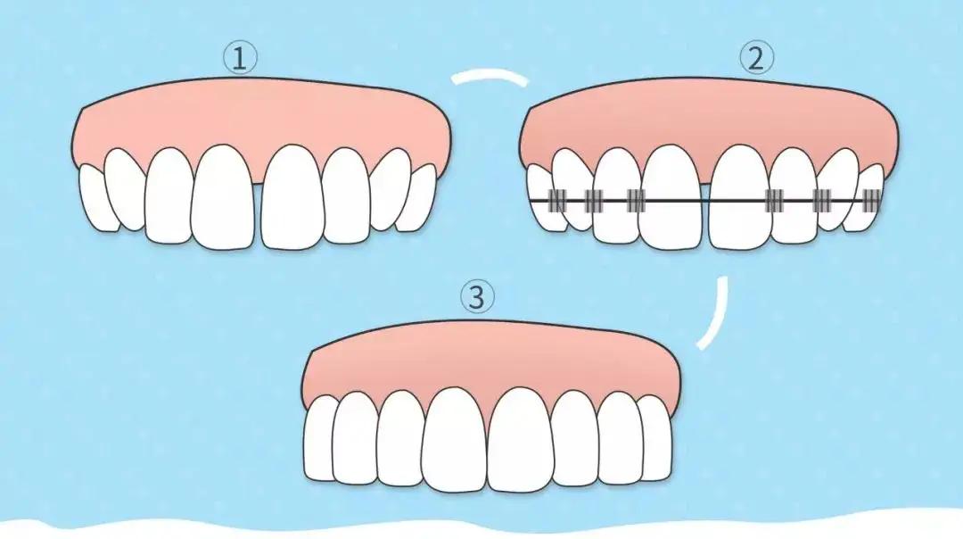 世界微笑日总结,世界微笑日口腔医院