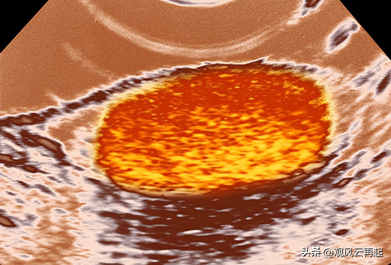 肠胃癌症的早期症状表现有哪些,鼻咽癌症的早期症状都有哪些表现