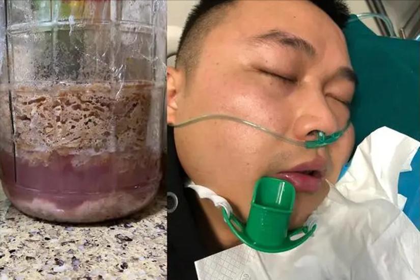 自酿葡萄酒的危害四年,自酿葡萄酒引发的惨剧