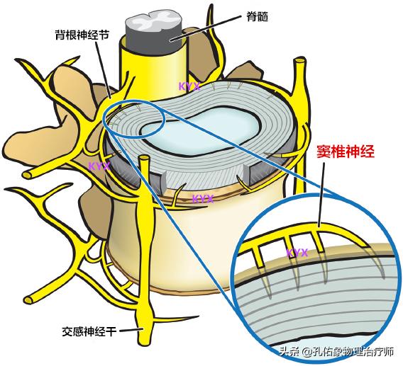 腰椎间盘突出要怎么治疗才好得快,腰椎间盘突出3个方法标本兼治