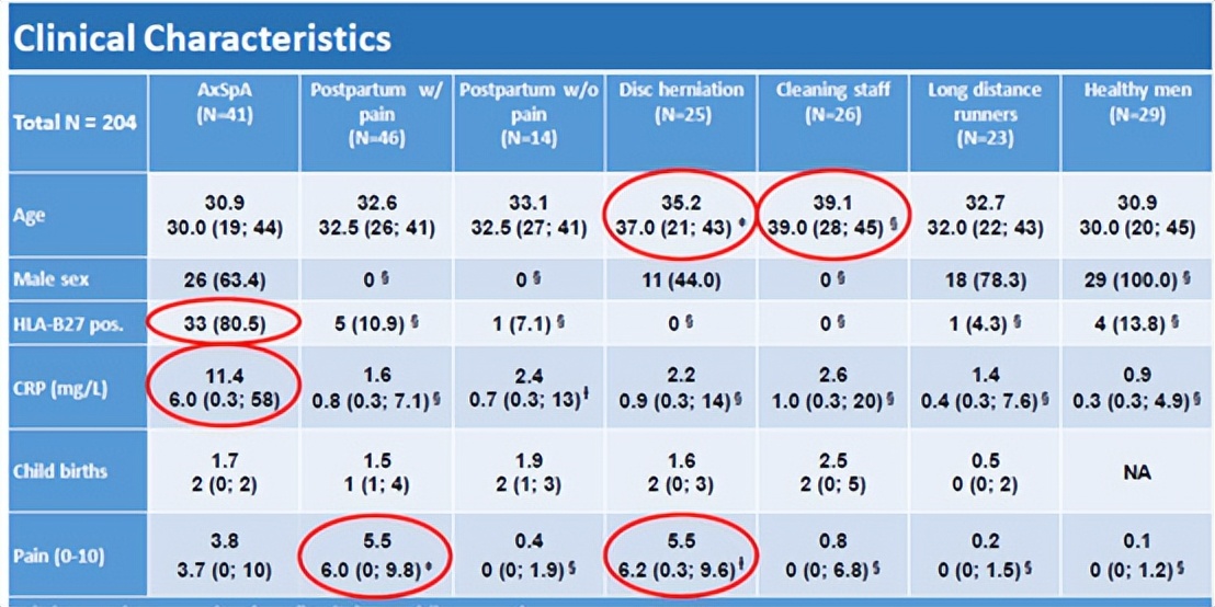 骶髂关节骨髓水肿最好的治疗方案,骶髂关节水肿是强直性脊柱炎吗