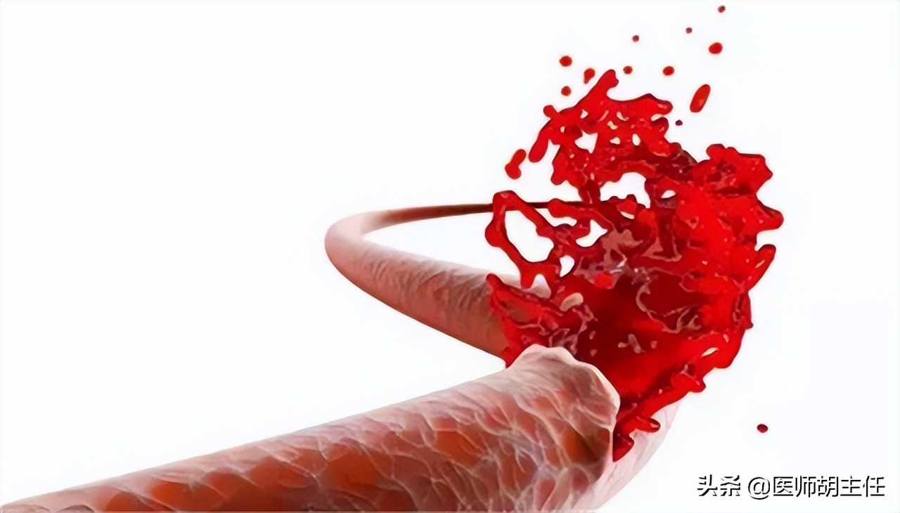 如果肠道长息肉身体会有哪些反应,肠道长息肉会有什么症状