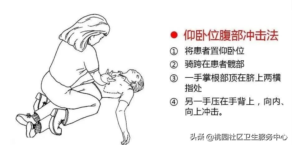 1-3岁幼儿异物卡喉海姆立克急救法,异物卡喉海姆立克急救法手法