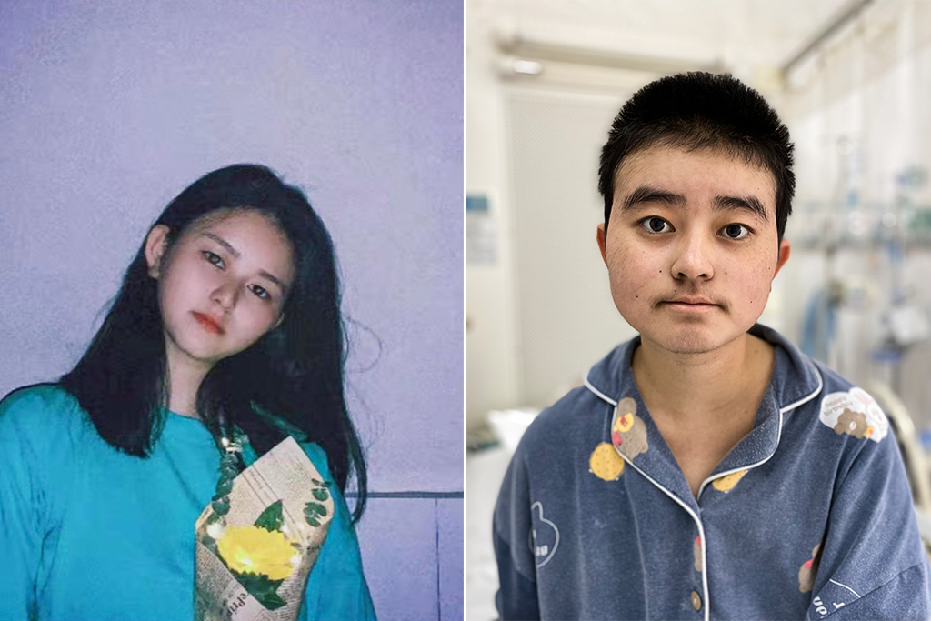 漂亮女孩患病,23岁女孩身体发生怪病