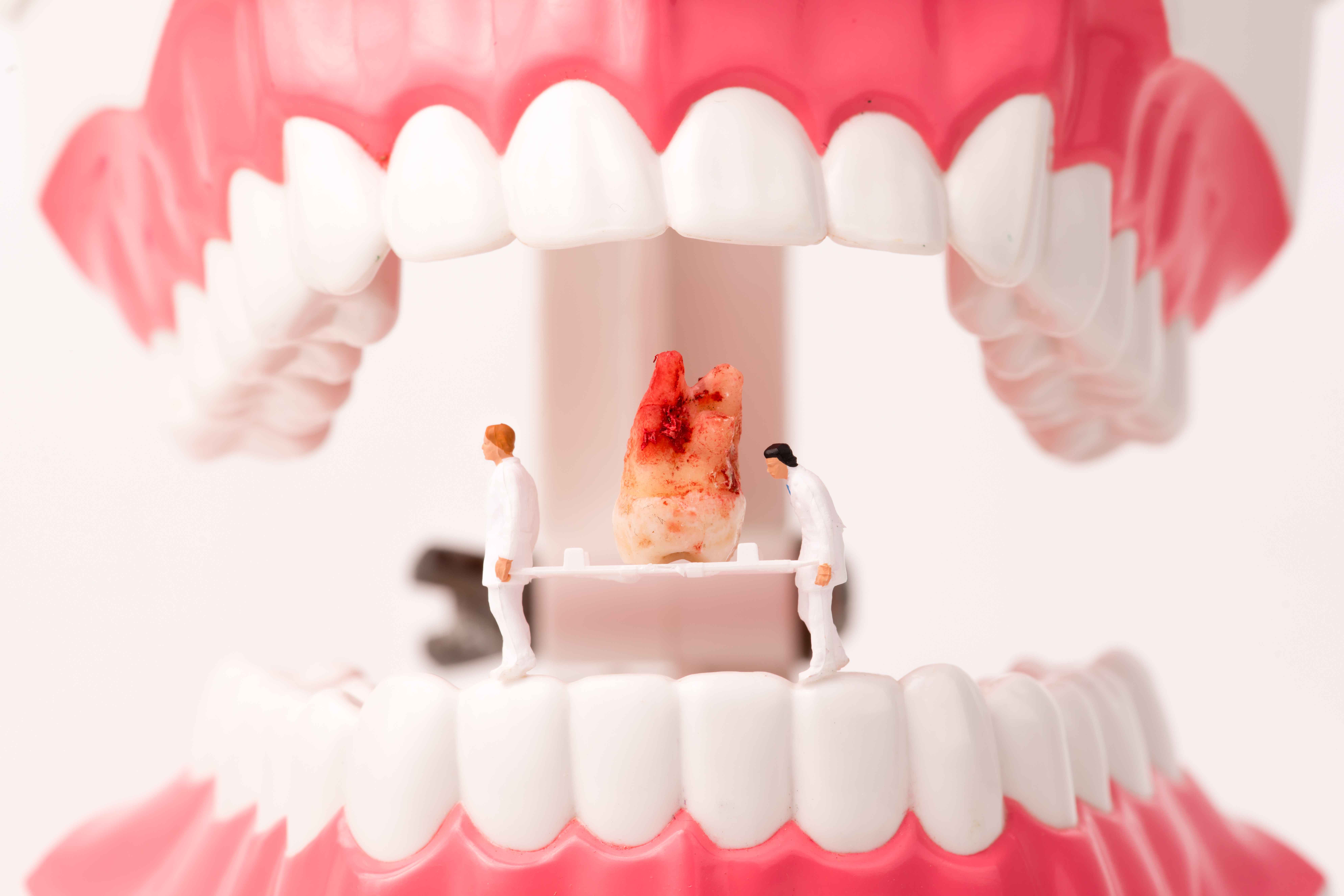 人到中年大牙松动要拔掉吗,人到中年牙齿松了会不会自动掉