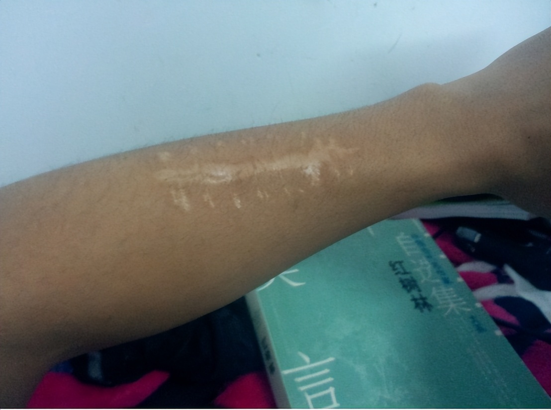 黑龙江孕妇诱骗16岁女护士，供丈夫玩乐后，将她杀害并抛尸荒野