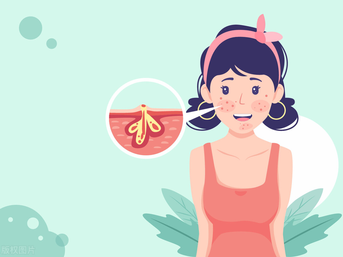 痘印不护肤可以消吗,痘印不处理会自己消退吗