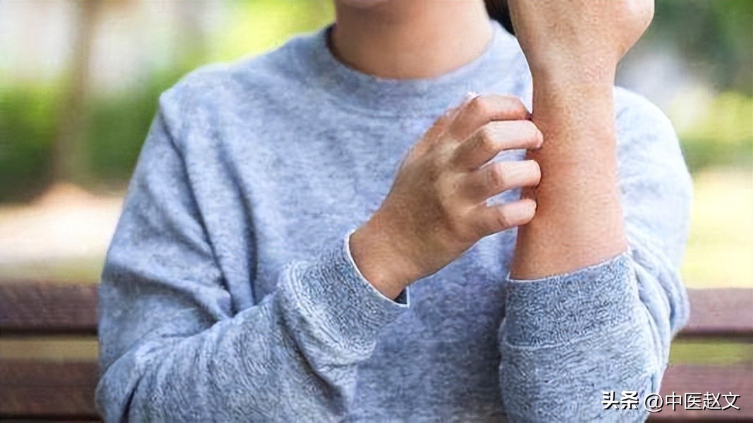 夏季皮炎止痒的方法,皮炎湿疹怎么快速止痒