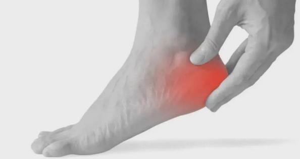 下地走路脚后跟痛走一会儿后缓解,跑完步脚后跟疼痛如何缓解