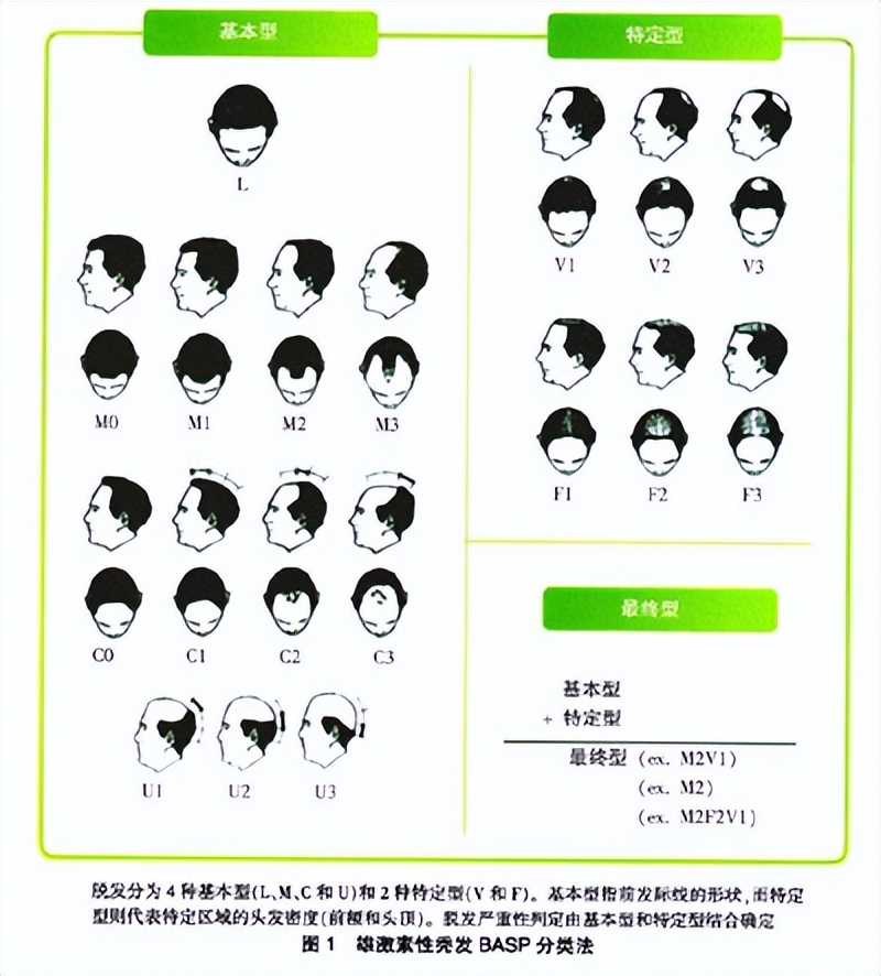 连明星都逃脱不了的高发际线时尚,雄秃现状