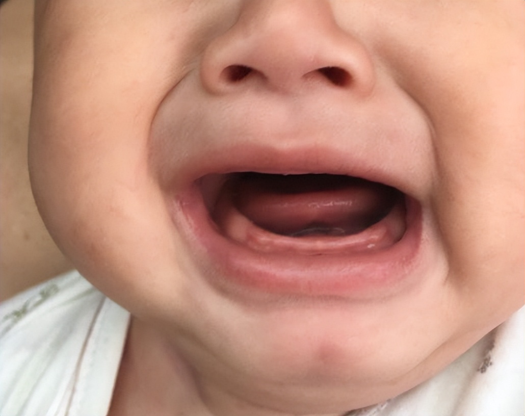 宝宝出牙晚缺钙怎么办,缺钙的孩子出牙晚吗