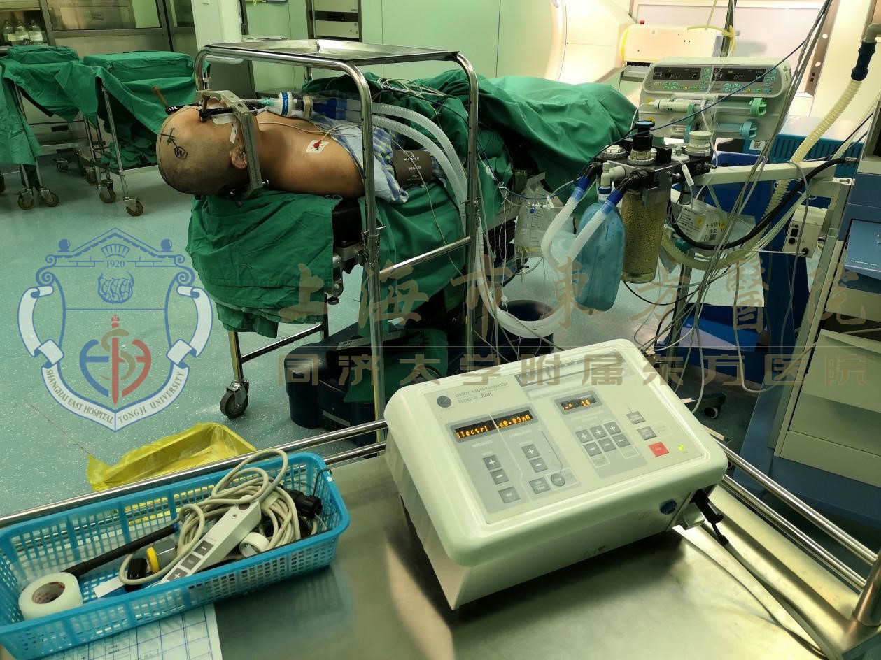 精神分裂症不配合就医,精神分裂症想停药又担心复发