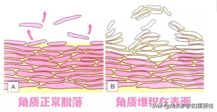 脸上干燥用护肤品有刺痛感,皮肤干用护肤品会刺痛是什么原因