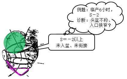 孕妈妈怎么判断胎位是正的,胎儿屁股在右侧是什么胎位