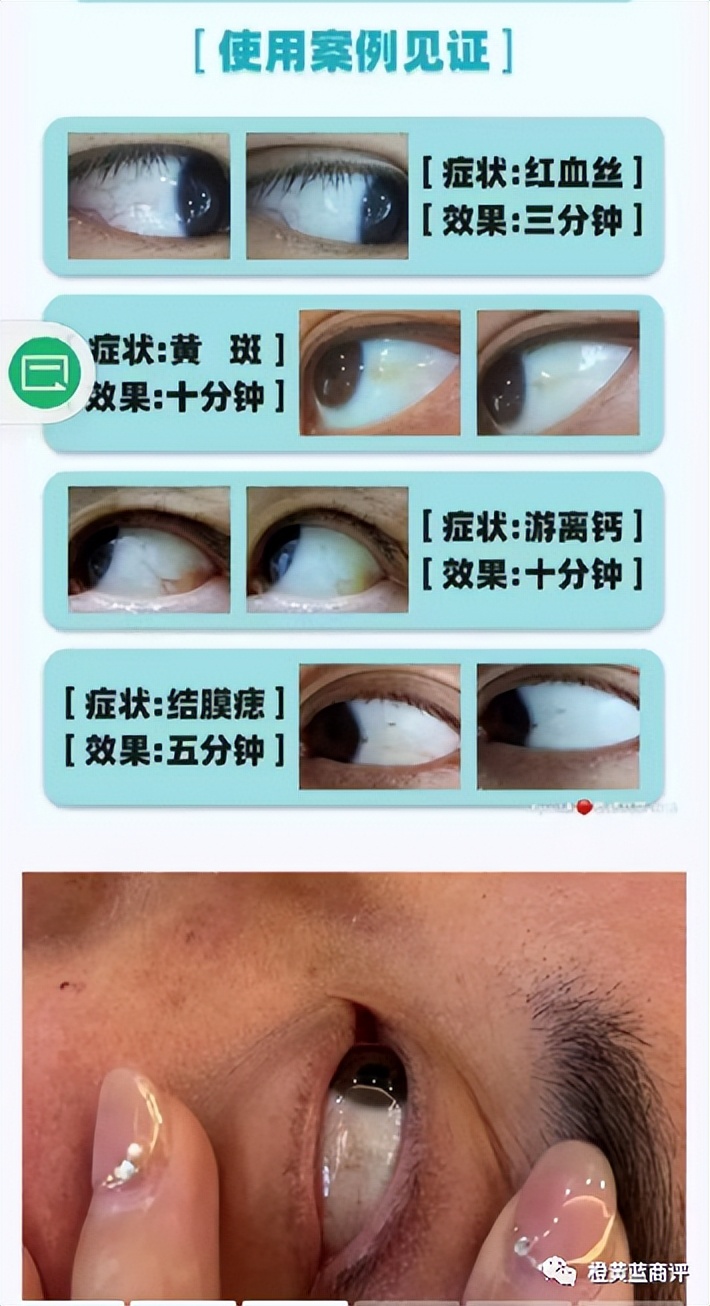 “今生睛视”牵手“三八妇乐”能碰出怎样的火花？