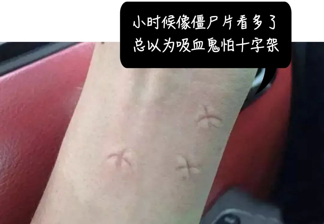o型血的人最容易被蚊子咬吗,蚊子最爱o型和b型血