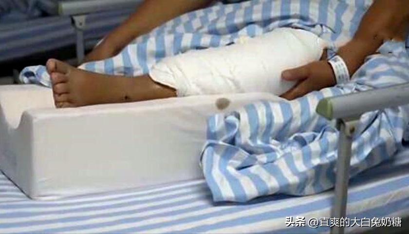 李亚诺断骨增高怎样了,断骨增高手术的李亚诺现状