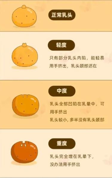 关于乳房的几个冷知识,医生建议:了解一下,别害羞