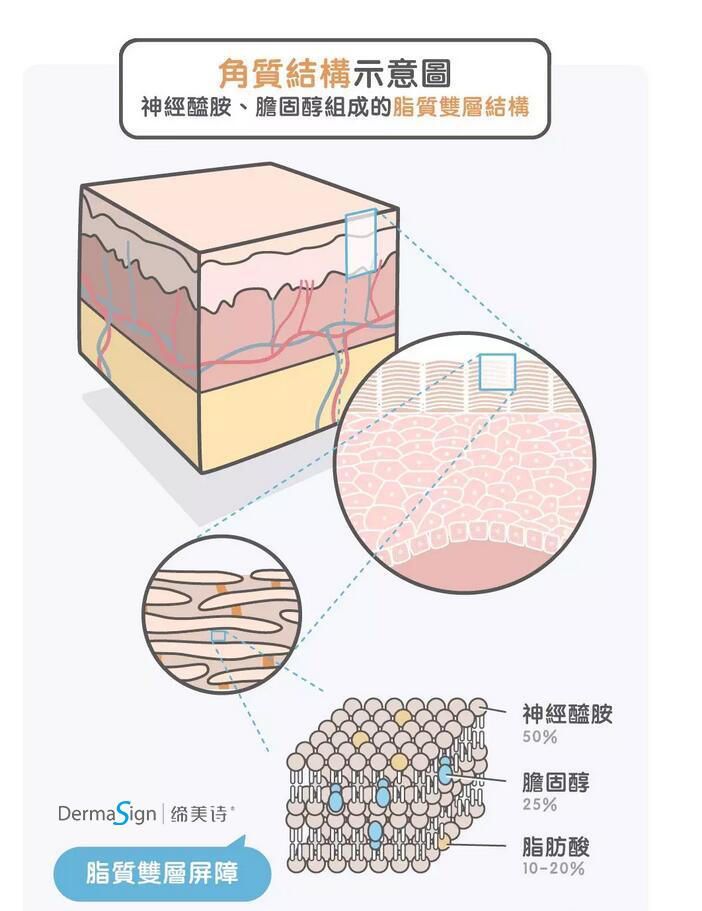 女生皮肤角质层薄怎么办,角质层薄要什么护肤品
