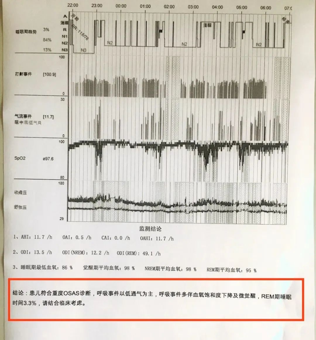 男孩打呼噜有什么好方法治疗吗,17岁的男孩打呼噜怎么回事