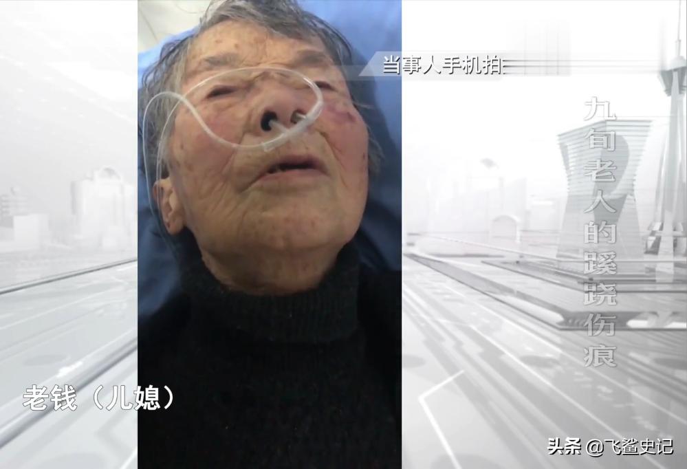 母亲被火灾烧伤,母亲被火烧死后续