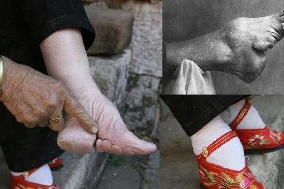 三寸金莲从哪个朝代开始,三寸金莲女鞋