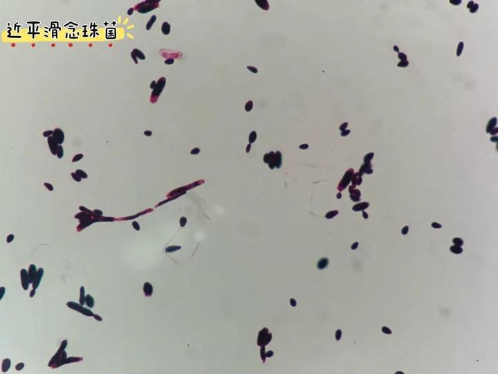 经常穿紧身内裤的坏处,经常穿紧身裤子对身体有影响吗