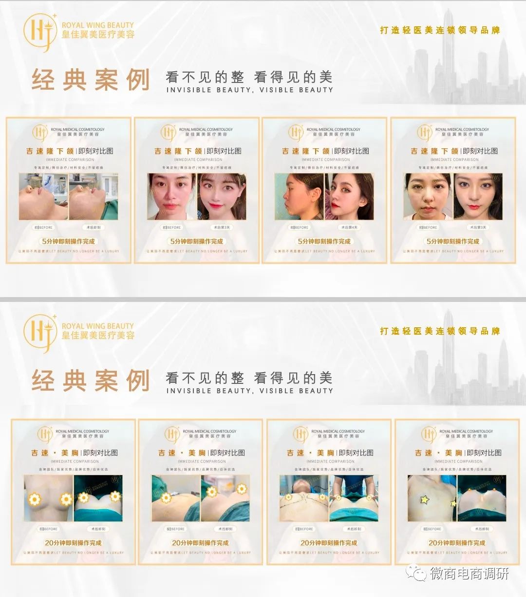 不手术不开刀无痛丰胸,不手术不开刀无痕丰胸