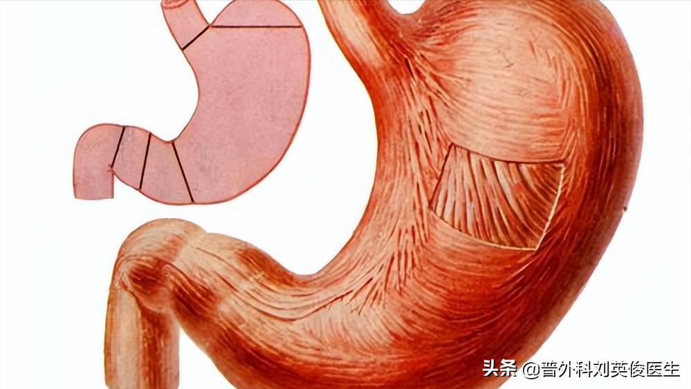 吃动物血排黑色大便是怎么回事,吃了动物血大便变黑是肺在排毒吗