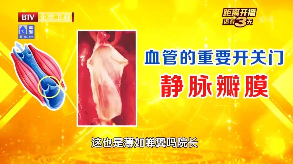 腿酸胀难受怎么缓解静脉曲张,单腿小腿酸胀发麻是静脉曲张吗