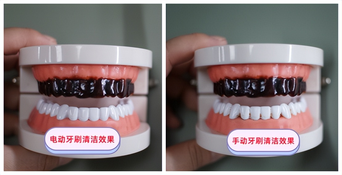 购买电动牙刷需要注意什么,电动牙刷选购攻略