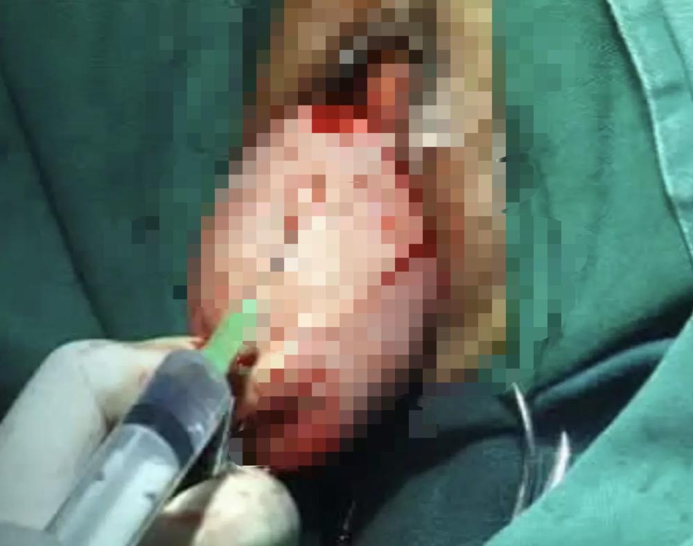 痛苦的疾病治疗,妇科疾病有没有完全治愈的