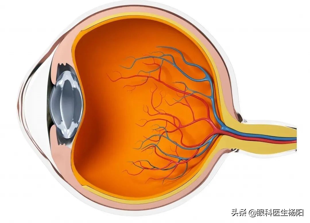没有眼屎患白内障,狗患白内障怎么办