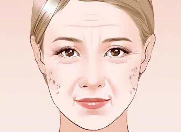 牙膏与红霉素软膏能祛老年斑吗,老年斑消除偏方红霉素软膏加甘油