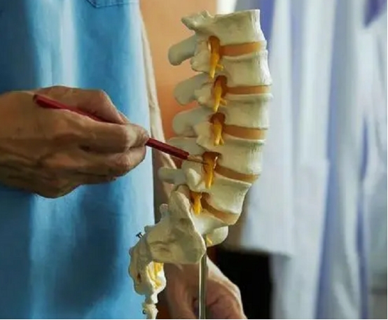 女子腰椎间盘突出,女性腰痛和腰椎间盘突出