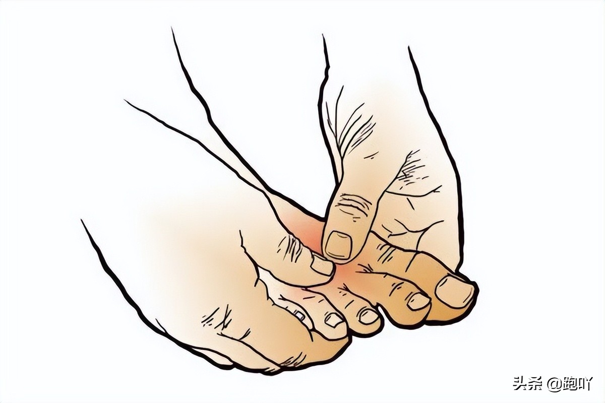 三个动作教你居家缓解足底筋膜炎,足底筋膜炎十大膏药