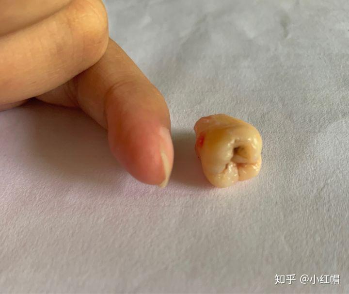 最可怕的癌症复发方式,癌症复发恐惧