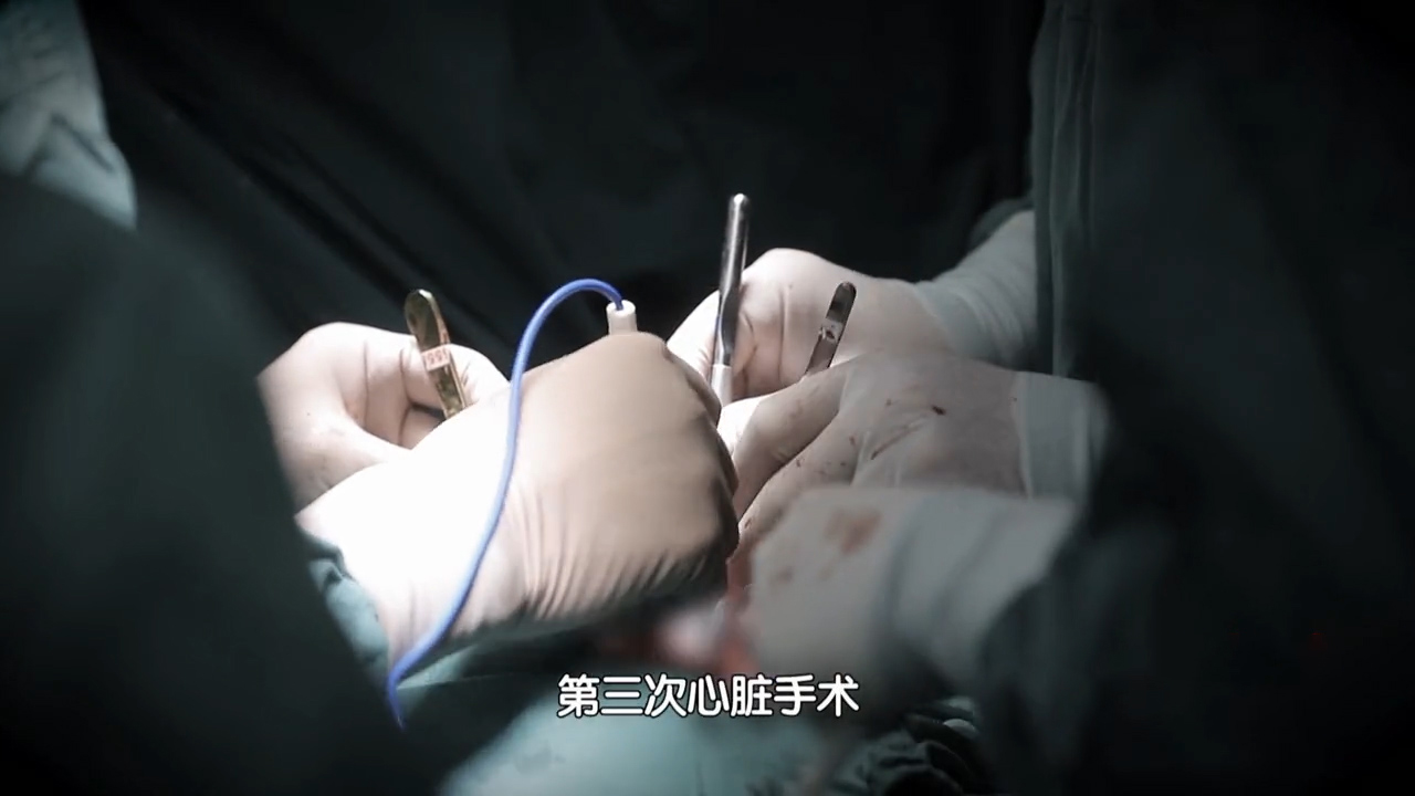 心脏发育畸形,九岁男孩经历四次心脏手术