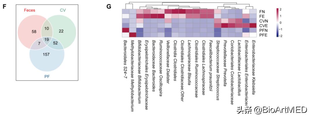 菌群异常会导致子宫内膜异位症吗,肠型子宫内膜异位症