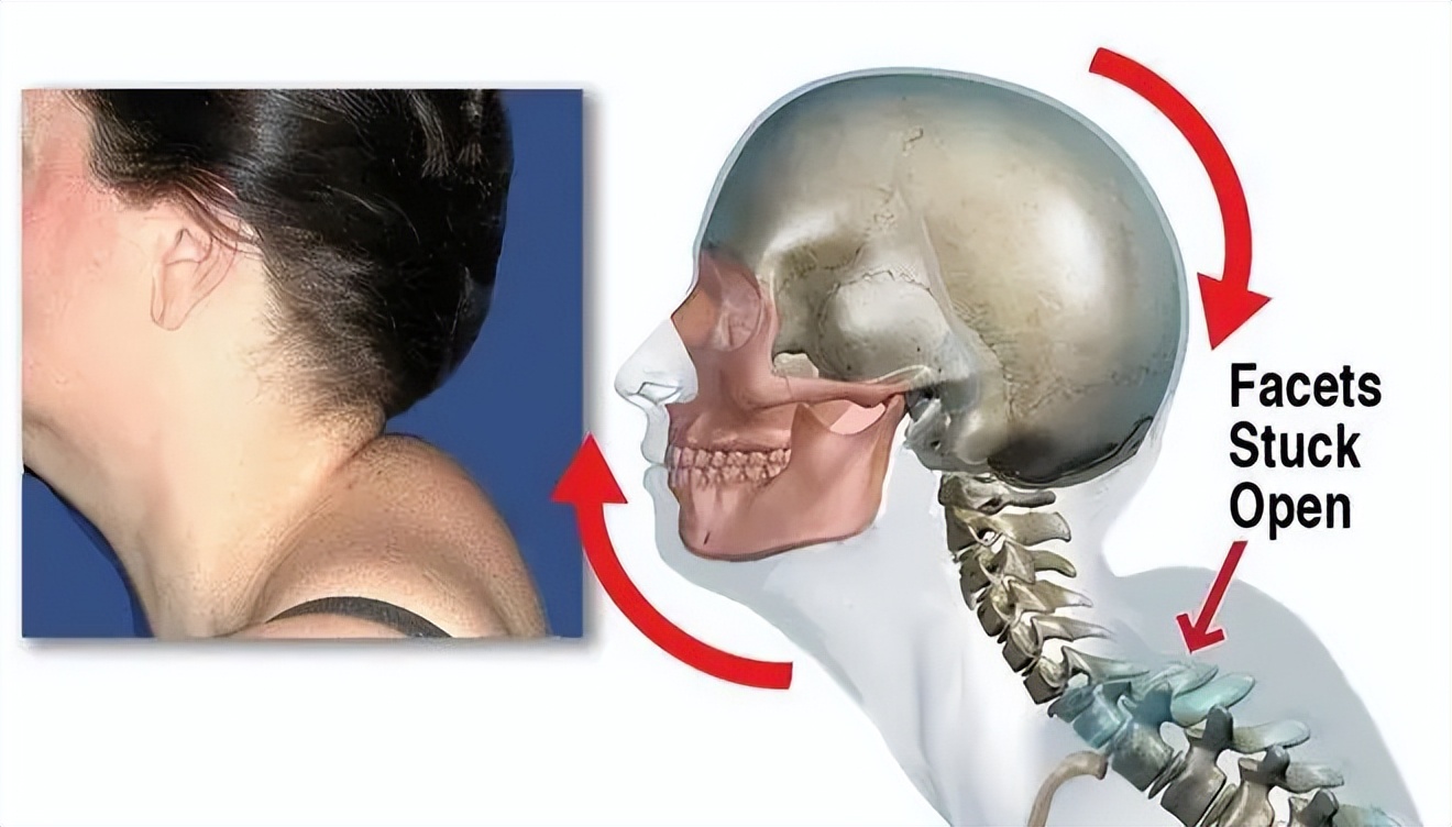 富贵包真的很丑吗,有富贵包会影响寿命吗
