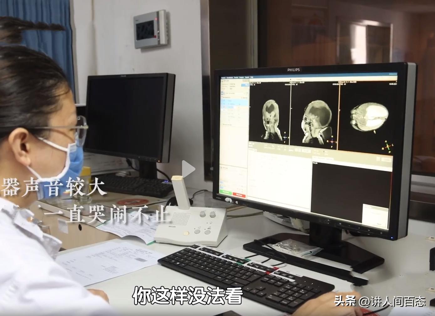 被丢在桥洞下的孩子后续,孩子被遗弃后脑长肿瘤