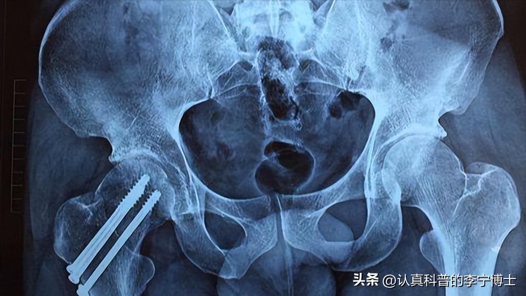 晚上夜尿几次是什么原因怎样治疗,年轻人夜尿几次属于正常