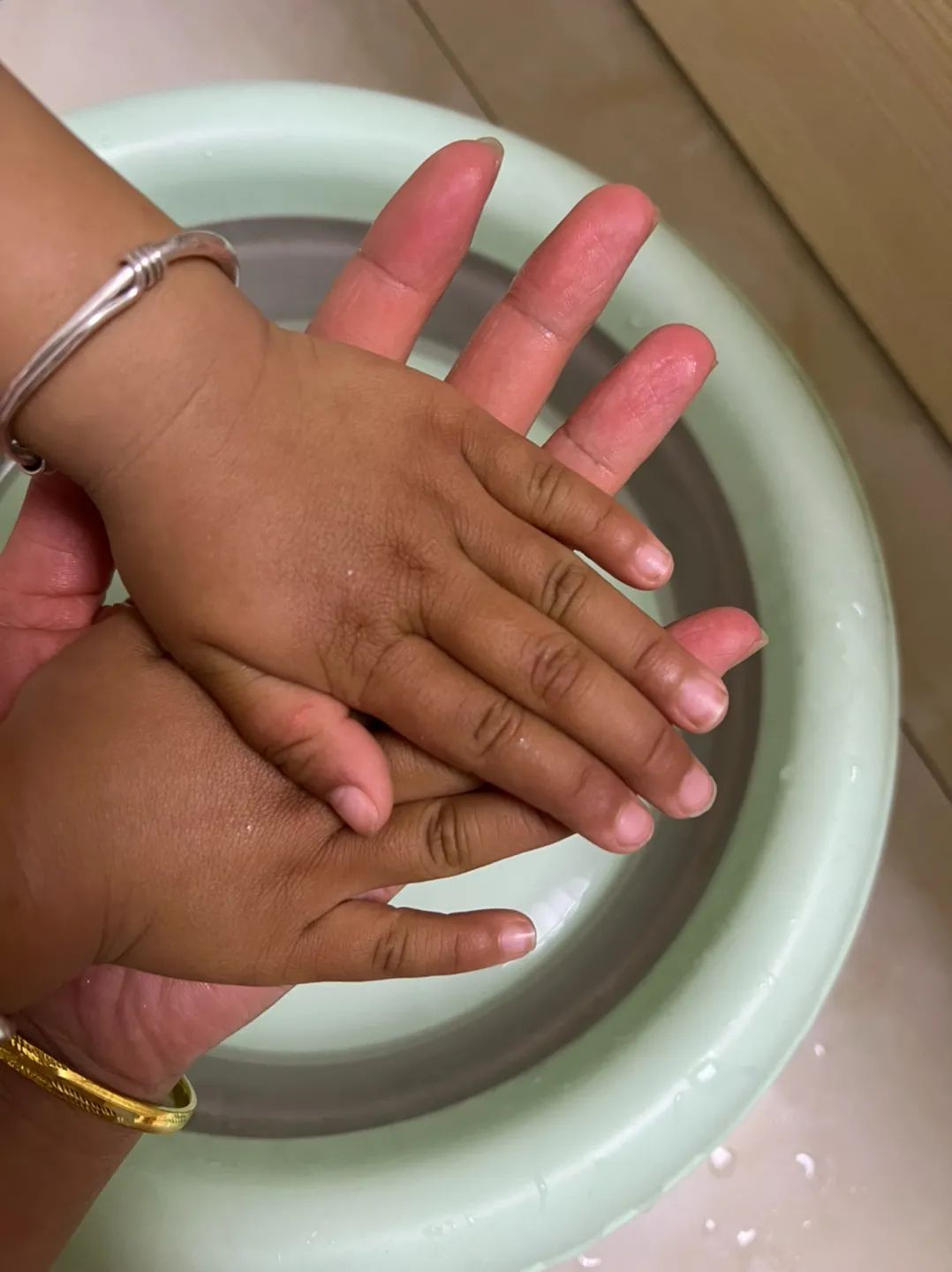 宝宝越养越黑了怎么回事,孩子越养越瘦越黑怎么回事